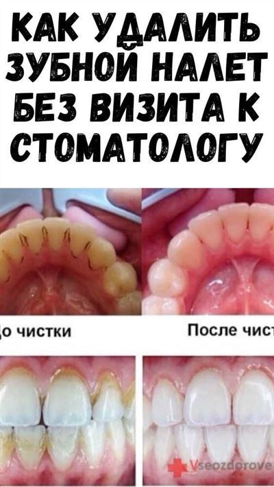 Как получить компенсацию от страховой компании: шаги и последовательность действий