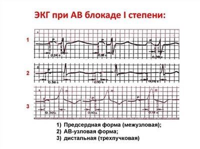 Последствия и профилактические меры