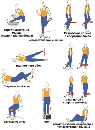 Разрыв связок колена – сроки восстановления